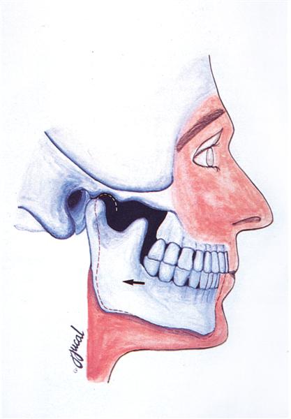 Diagram showing the jaw bone and muscle