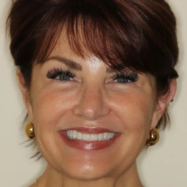 Rosa’s Path to a Beautiful Smile
