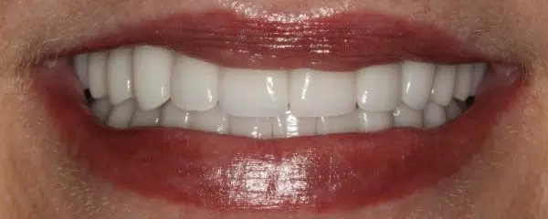 Rosa’s Path to a Beautiful Smile