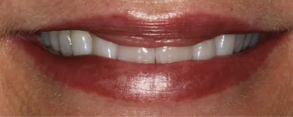 Rosa’s Path to a Beautiful Smile
