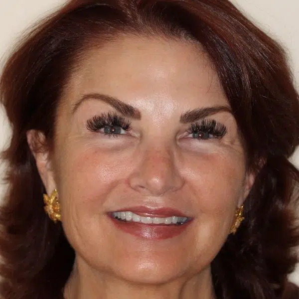 Rosa’s Path to a Beautiful Smile